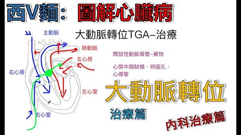 逆時針|心臟呈逆鐘向轉位，怎麼辦